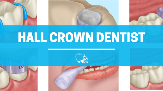 Hall Crown Dentist Arctic Dental Muscatine Pediatric Dentistry